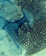 Utharomyces columella and spores