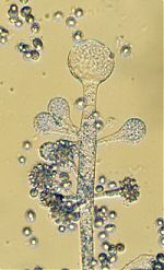 Vesicles and spores of Cunninghamella echinulata