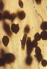 Chlamydospores of Phascolomyces articulosus