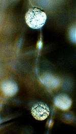 Rhizopus stolonifer sporangia showing crack in the spore mass