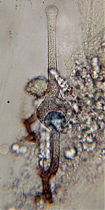 Sporangium of Saksenaea