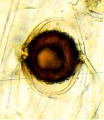 Absidia spinosa zygospore