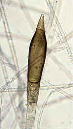 Chlamydospore of Chlamydoabsidia padenii