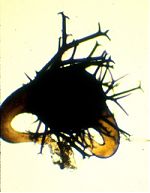 Zygospore of Phycomyces